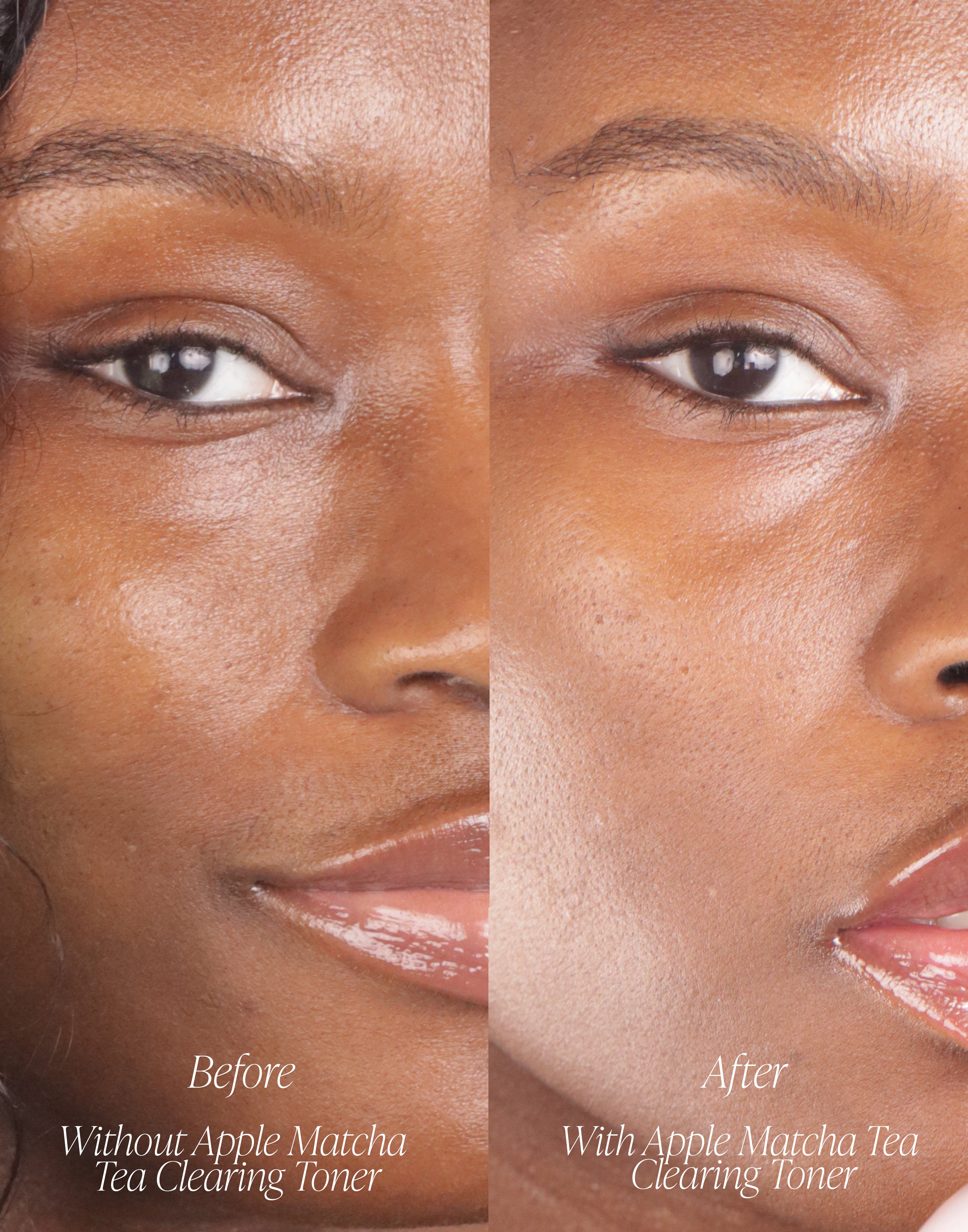 Apple Matcha Tea Clearing Toner