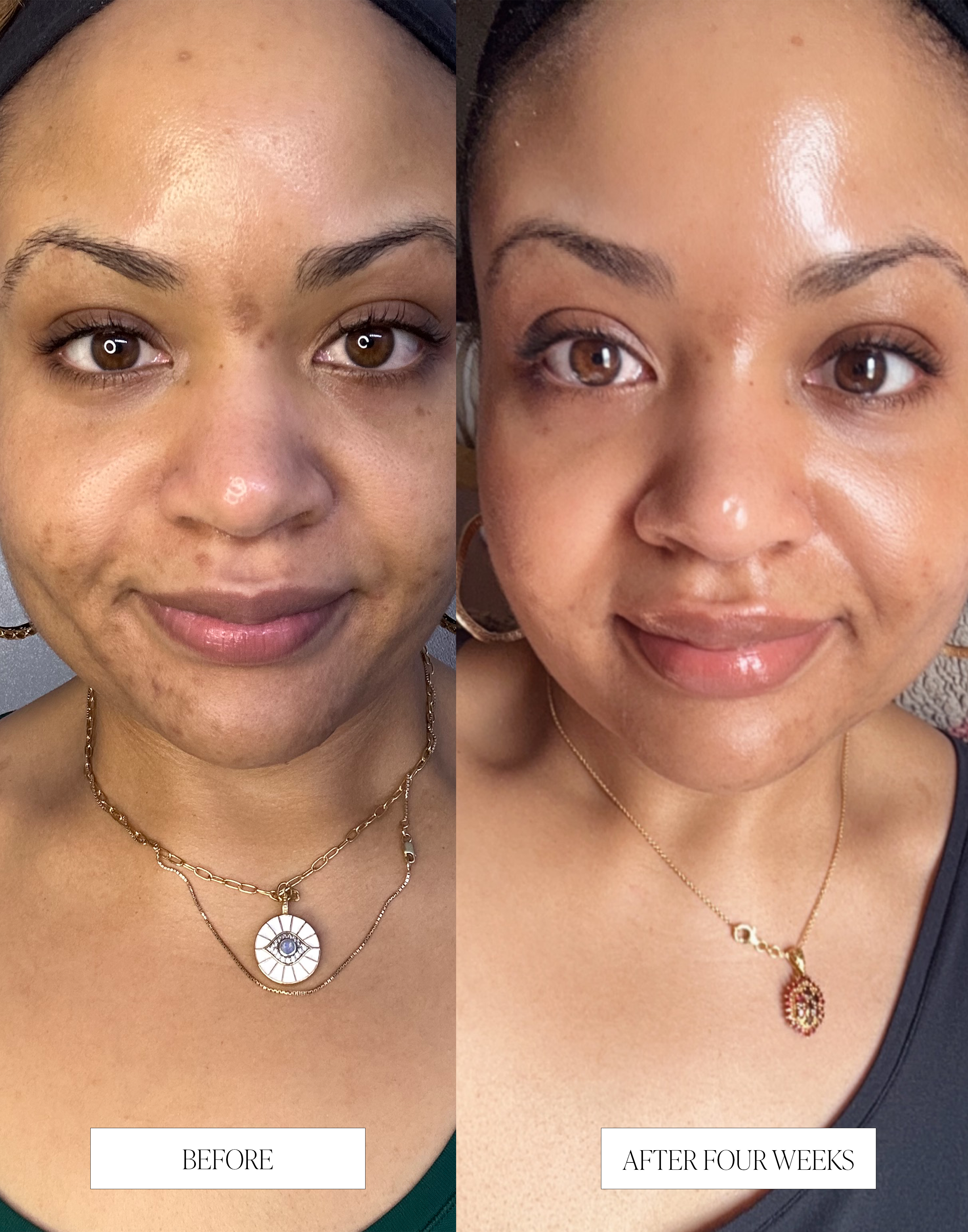 Celery AHA + LHA Resurfacing Serum