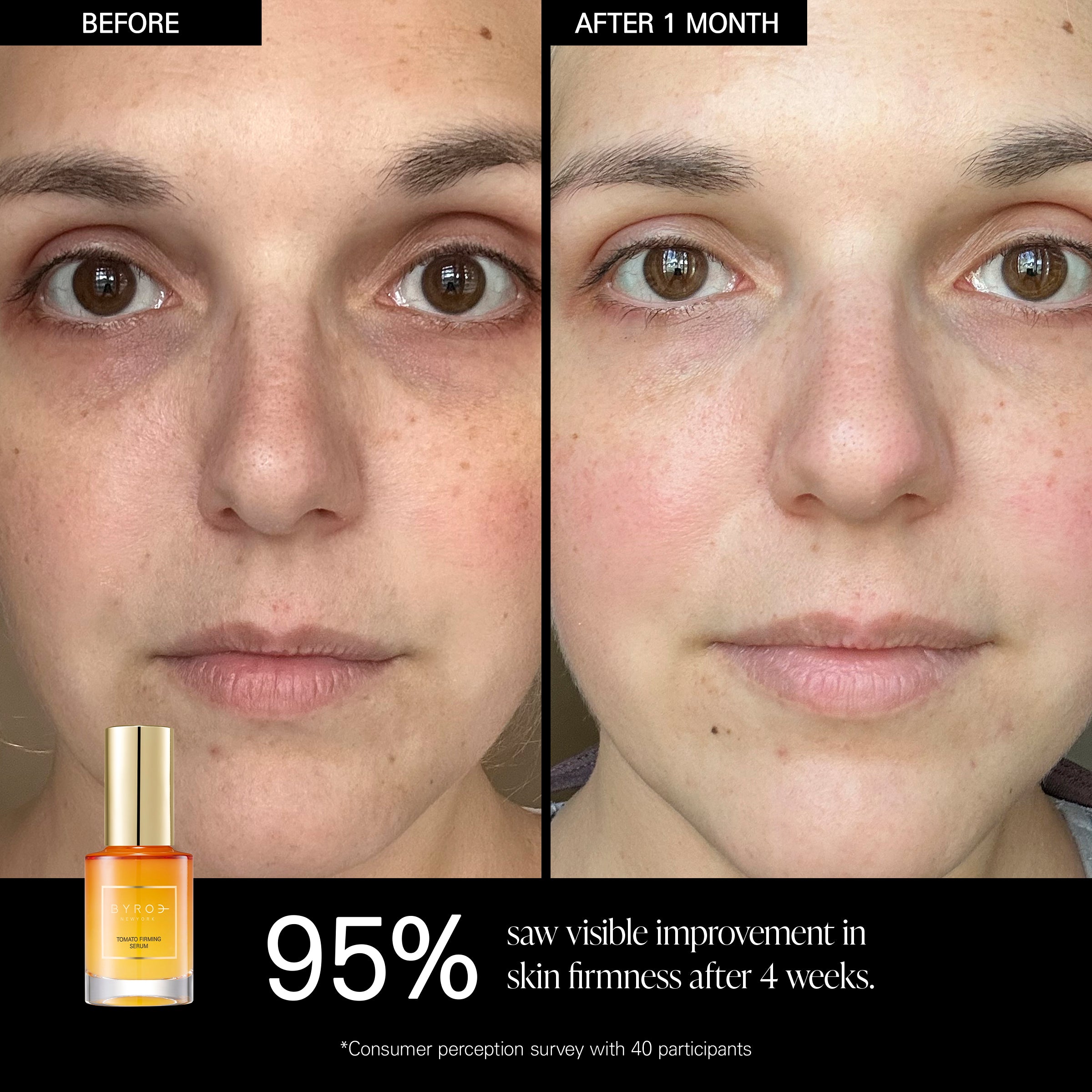 Tomato Serum | Anti Aging Treatment | BYROE