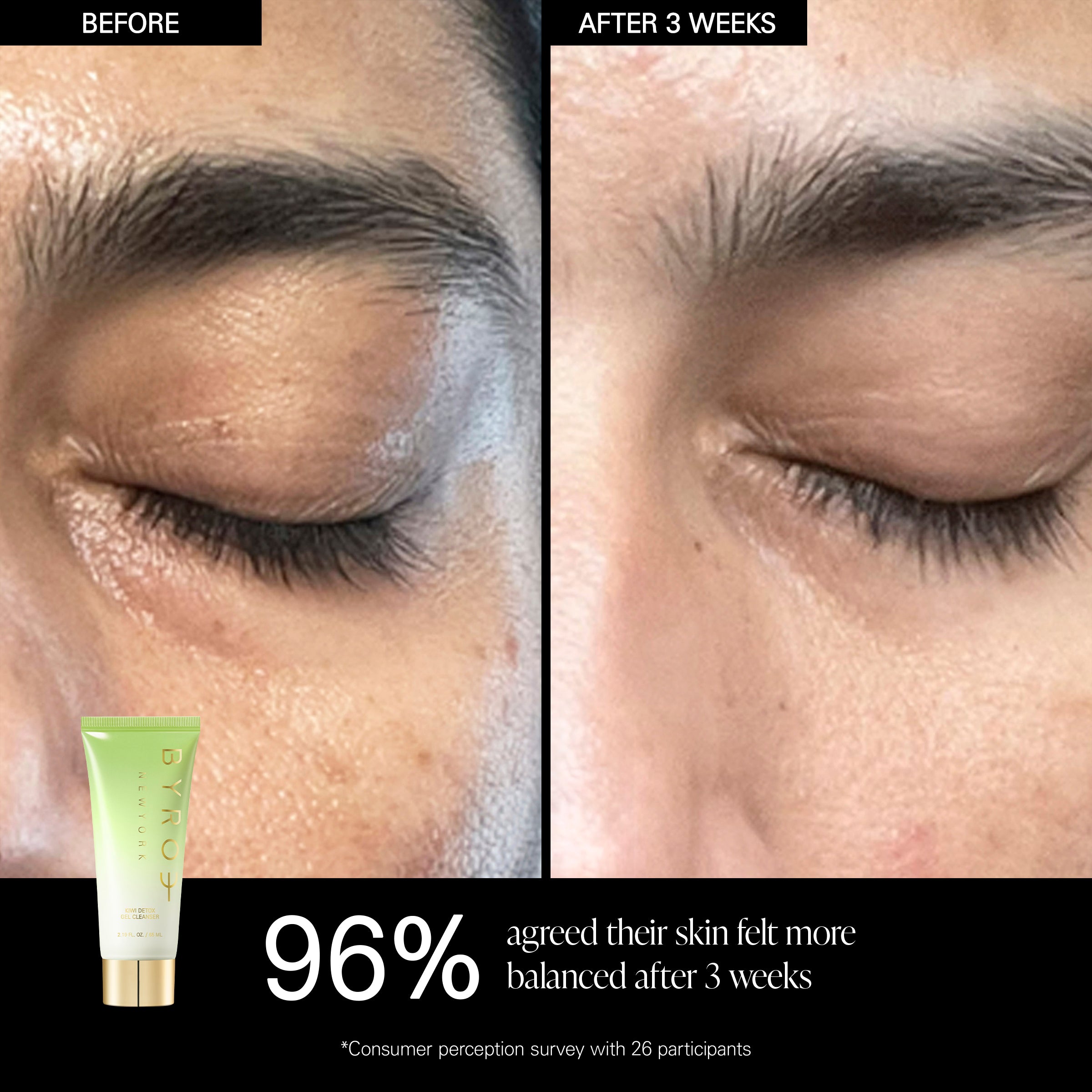 Your Skin’s Green Flag