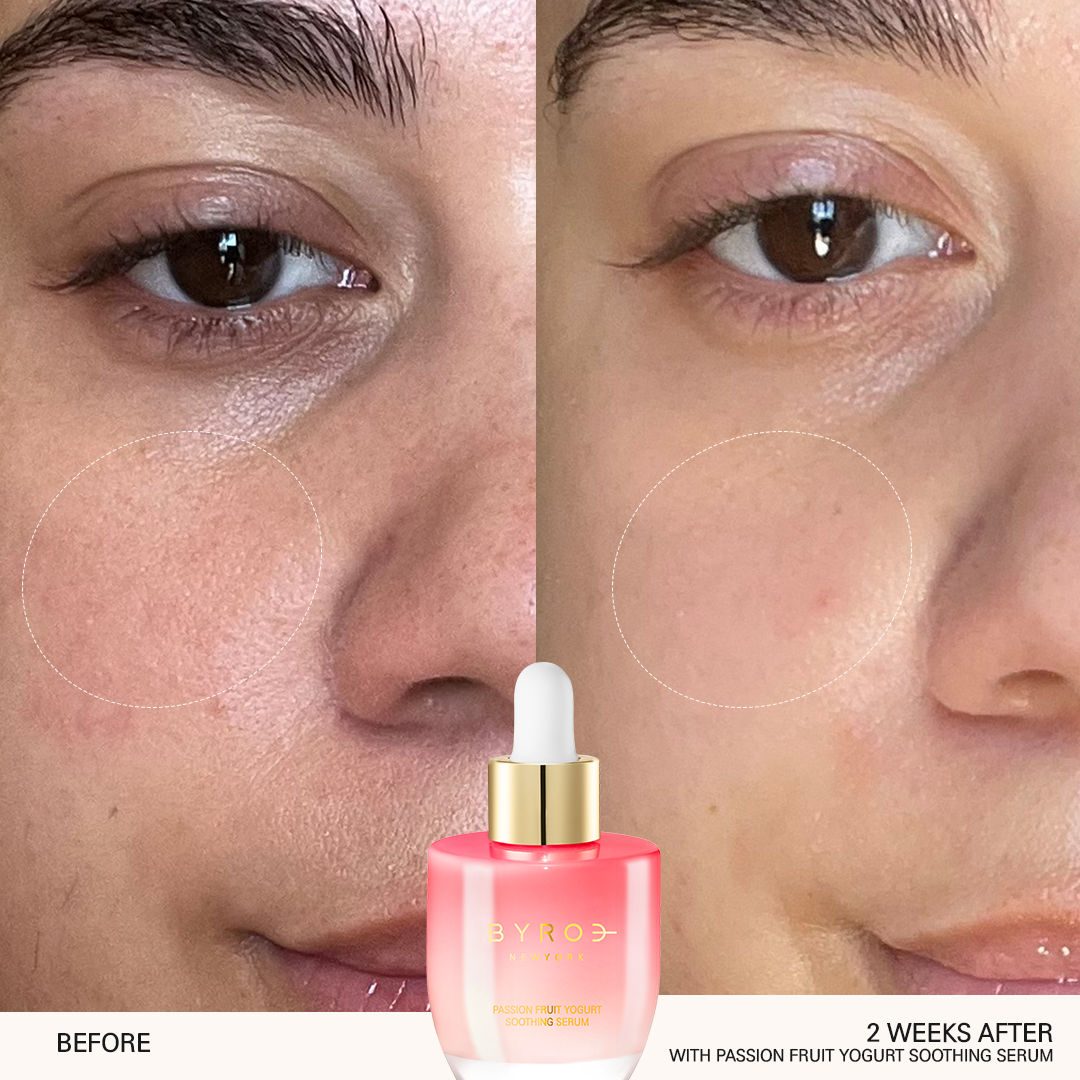 Passion Fruit Yogurt Soothing Serum Before + After