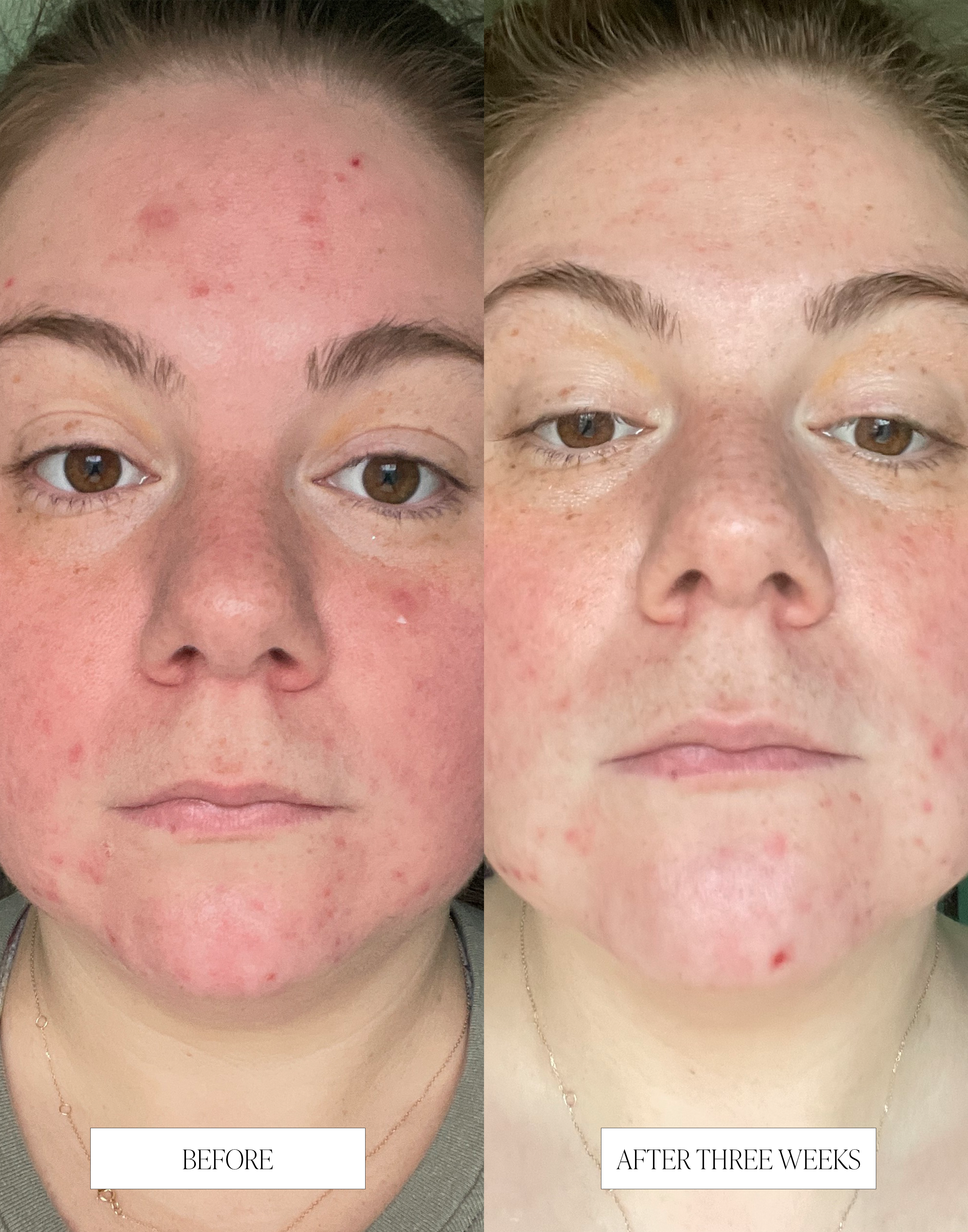 Celery AHA + LHA  Resurfacing Serum