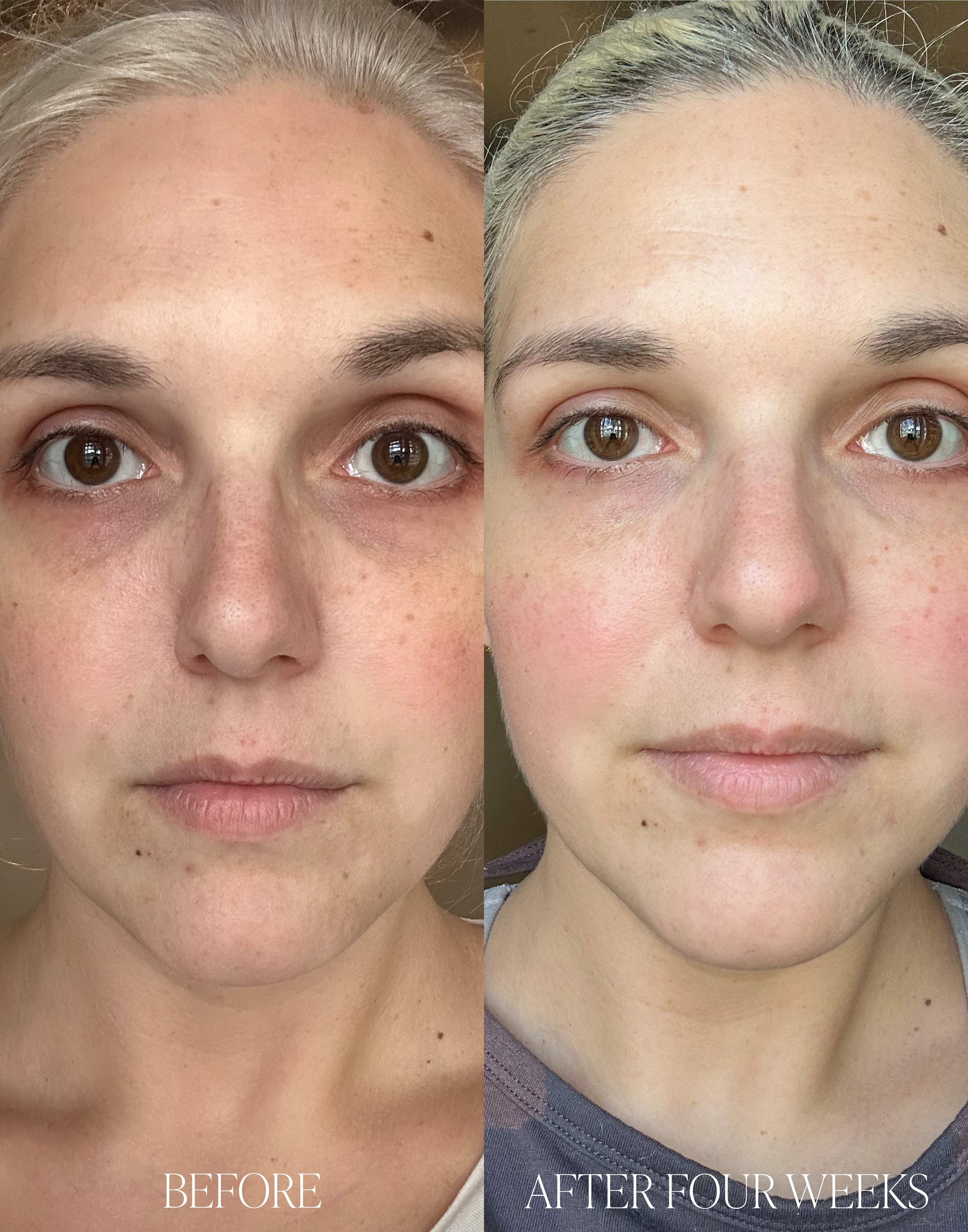 Tomato Firming Serum
