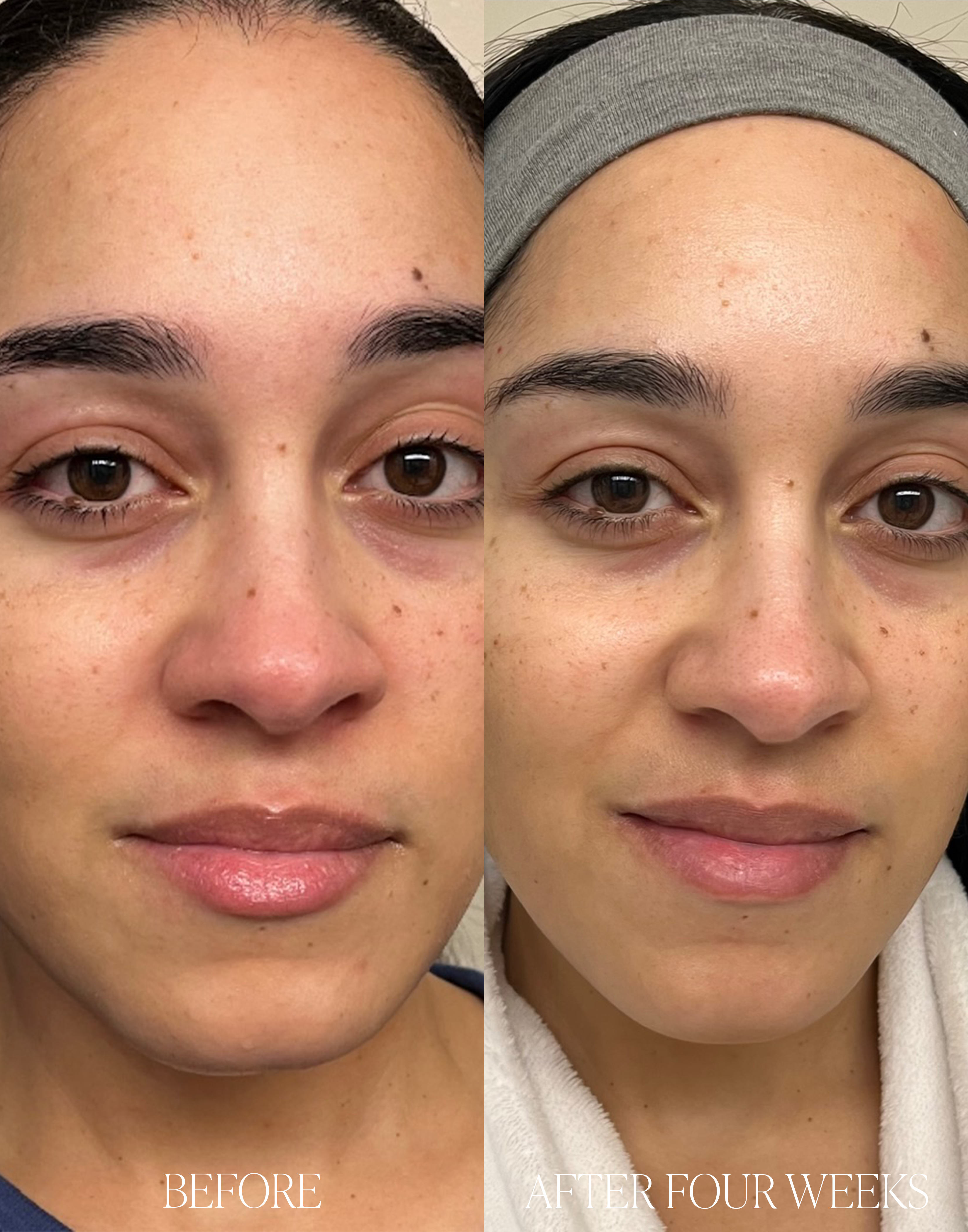Tomato Firming Serum
